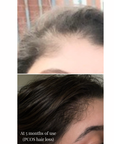 Doctor's Secret Hair Growth Oil For Scalp & Roots (100ml)
