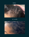 Doctor's Secret Hair Growth Oil For Scalp & Roots (100ml)