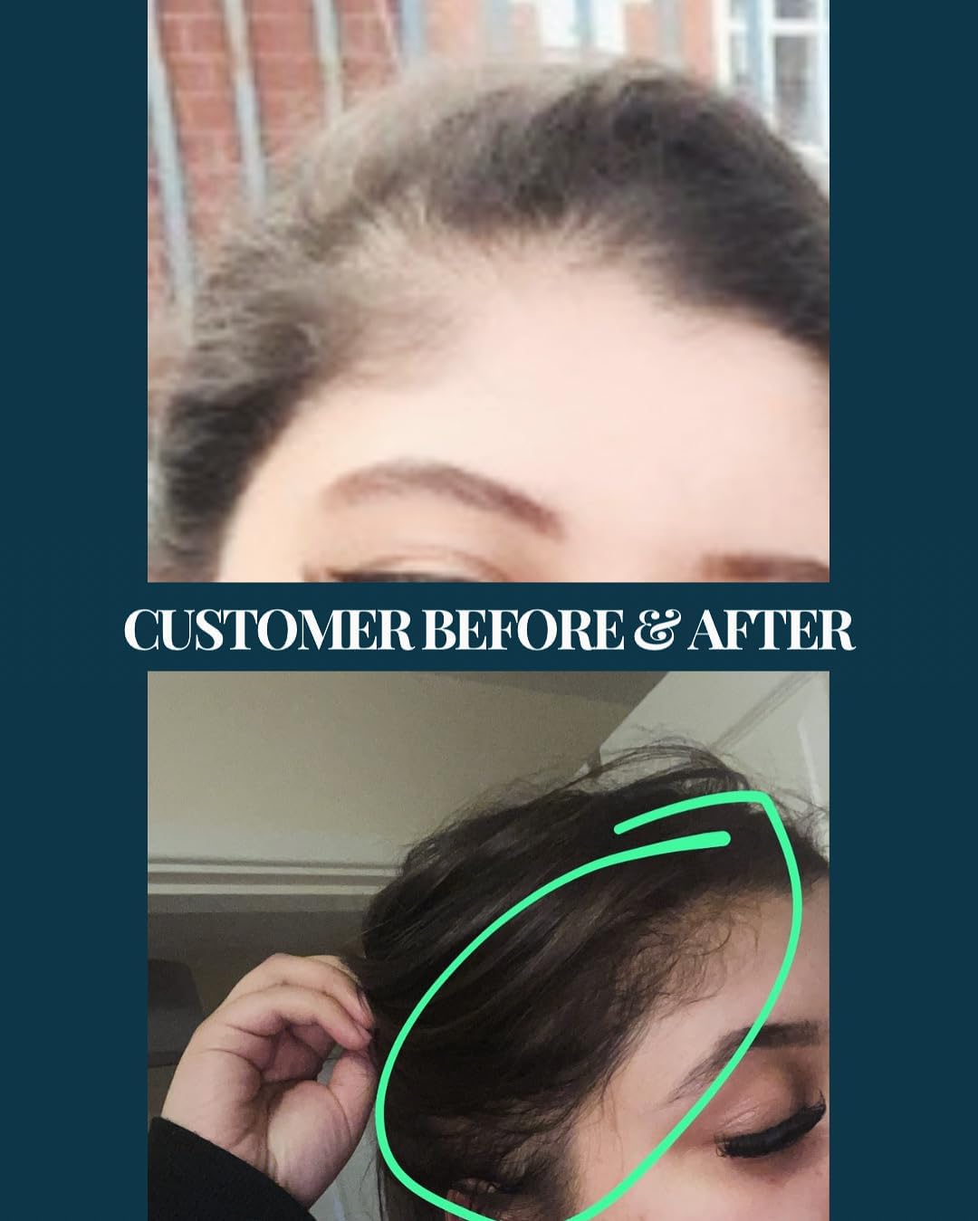 Doctor's Secret Hair Growth Oil with Rosemary, Castor, Lavender, Peppermint, Caffeine, Rosehip and Sweet Almond Oils. 100% Natural Vegan, Doctor Formulated For Thinning Hair (100ml)